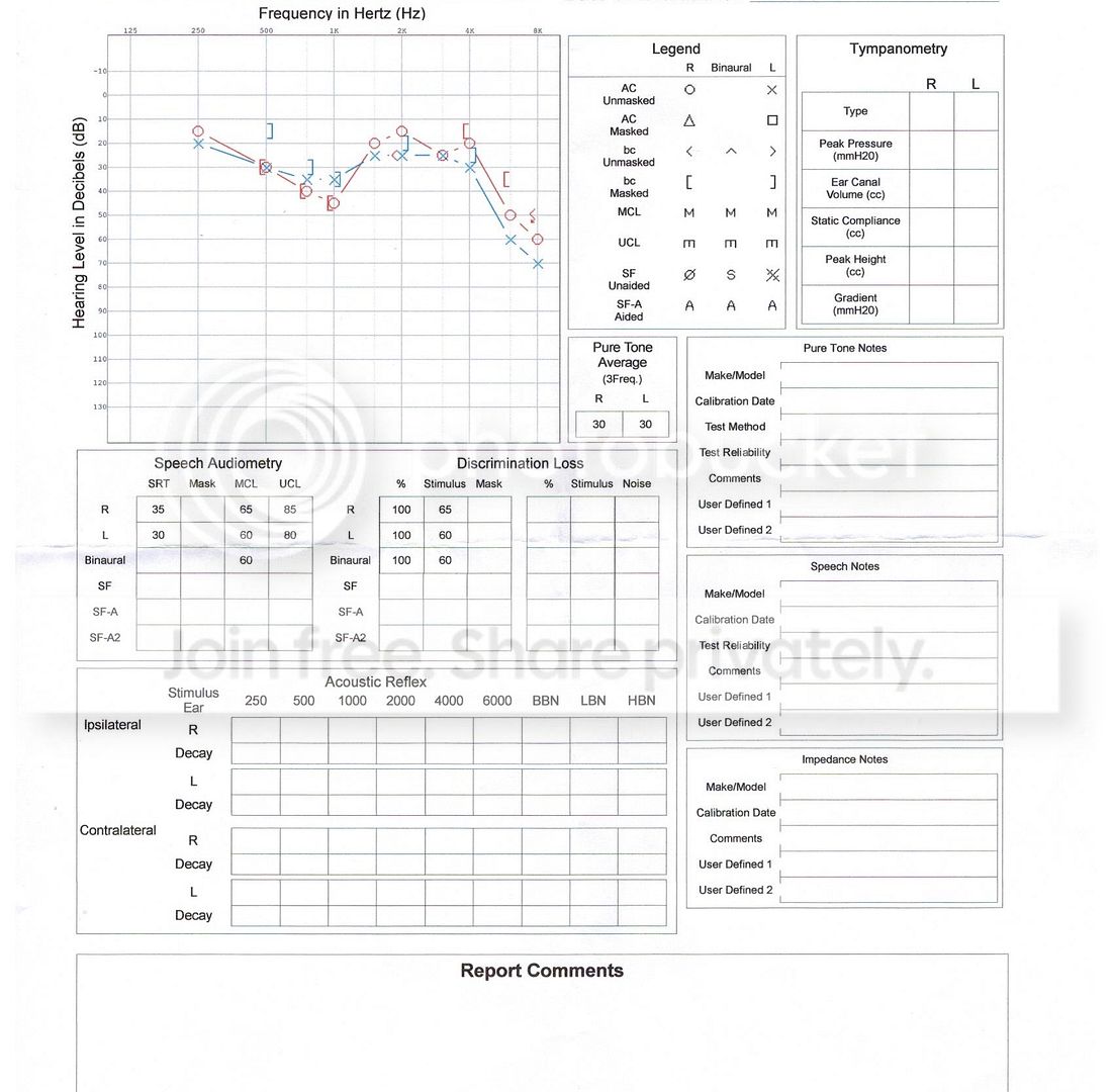 Two Different Results On Audiograms Should I Get A Third Hearing
